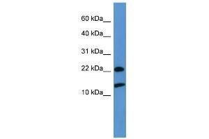 WB Suggested Anti-RPS27A Antibody Titration: 0. (RPS27A 抗体  (Middle Region))