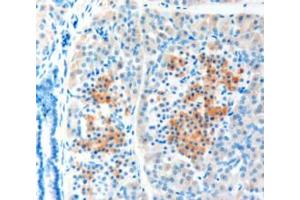 ABIN185410 (1µg/ml) staining of paraffin embedded Human Pancreas shows staining of cytoplasm in some cells of the islets of Langerhans. (LRP5 抗体  (Internal Region))