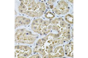Immunohistochemistry of paraffin-embedded human kidney using GALNT2 Antibody (ABIN5974158) at dilution of 1/100 (40x lens). (GALNT2 抗体)