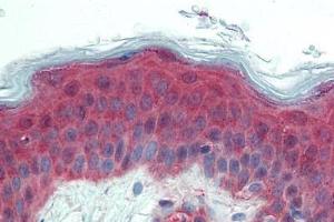 Anti-ITGA3 / CD49c antibody  ABIN1048975 IHC staining of human skin. (ITGA3 抗体  (Internal Region))