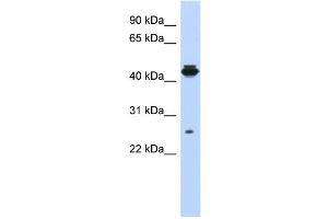 WB Suggested Anti-PDIK1L Antibody Titration: 0.