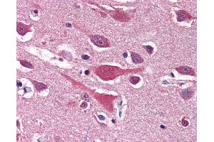 Anti-LRRC7 antibody IHC of human brain, cortex. (LRRC7 抗体  (N-Term))