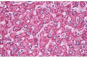 Image no. 3 for anti-Superoxide Dismutase 2, Mitochondrial (SOD2) antibody (ABIN1496289) (SOD2 抗体)