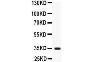Observed bind size: 35KD (Liver Arginase 抗体  (N-Term))