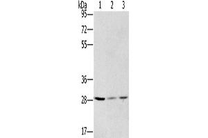 Western Blotting (WB) image for anti-Hydroxysteroid (17-Beta) Dehydrogenase 12 (HSD17B12) antibody (ABIN2423602) (HSD17B12 抗体)