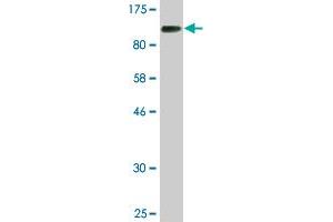 Western Blot detection against Immunogen (85. (CHEK2 抗体  (AA 1-543))