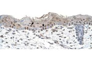 Immunohistochemical staining (Formalin-fixed paraffin-embedded sections) of human skin with ARRB2 polyclonal antibody  at 4-8 ug/mL working concentration. (Arrestin 3 抗体  (Internal Region))