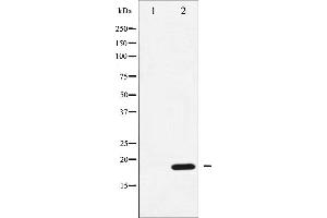 Western Blotting (WB) image for anti-Protein Phosphatase 1, Regulatory (Inhibitor) Subunit 14A (PPP1R14A) (pThr38) antibody (ABIN6256551)