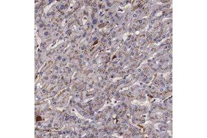 Immunohistochemical staining of human liver with APOH polyclonal antibody  shows moderate cytoplasmic positivity, with a granular pattern, in hepatocytes. (APOH 抗体)