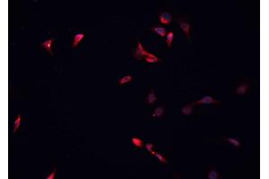 ABIN6266881 staining HeLa cells by IF/ICC. (HDAC5 抗体  (C-Term))