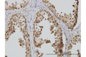 Image no. 4 for anti-DEAD (Asp-Glu-Ala-Asp) Box Polypeptide 6 (DDX6) (AA 1-484) antibody (ABIN598641) (DDX6 抗体  (AA 1-484))