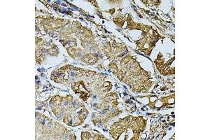 Immunohistochemistry of paraffin-embedded human stomach using CDH6 antibody. (CDH6 抗体  (AA 1-250))