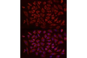 Immunofluorescence analysis of A-549 using EIF4B antibody (ABIN6127837, ABIN6140078, ABIN6140080 and ABIN6217245) at dilution of 1:25 (40x lens). (EIF4B 抗体  (AA 352-611))