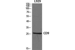 Western Blot (WB) analysis of specific cells using CD9 Polyclonal Antibody. (CD9 抗体  (Internal Region))