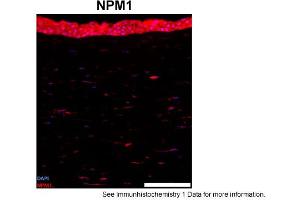 Sample Type: human cornea (frozen)Blue: DAPIRed: NPM1Primary Dilution: 1:100Image Submitted By: Geraint ParfittGavin Herbert Eye Institute . (NPM1 抗体  (N-Term))