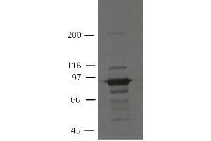 Image no. 1 for anti-Plakophilin 3 (PKP3) (AA 1-308) antibody (ABIN1169701) (Plakophilin 3 抗体  (AA 1-308))