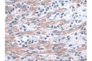 IHC-P analysis of Mouse Uterus Tissue, with DAB staining. (ITGA3 抗体  (AA 33-236))