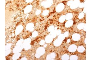 Formalin-fixed, paraffin-embedded Human Bone Marrow stained with CD71 Rabbit Recombinant Monoclonal Antibody (TFRC/2898R). (Recombinant Transferrin Receptor 抗体  (Extracellular Domain))