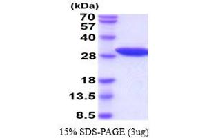 SDS-PAGE (SDS) image for Nicotinamide N-Methyltransferase (NNMT) (AA 1-264) (Active) protein (His tag) (ABIN6388116) (NNMT Protein (AA 1-264) (His tag))