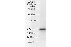 Western blot analysis of Human A549 cell lysates showing detection of BIM protein using Rabbit Anti-BIM Polyclonal Antibody . (BIM 抗体  (APC))