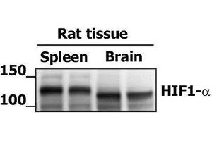 Western Blotting (WB) image for anti-Hypoxia Inducible Factor 1, alpha Subunit (Basic Helix-Loop-Helix Transcription Factor) (HIF1A) (AA 341-450) antibody (ABIN672546)