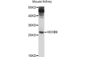 Western blot analysis of extracts of mouse kidney, using HOXB9 antibody (ABIN4903958) at 1:1000 dilution. (HOXB9 抗体)