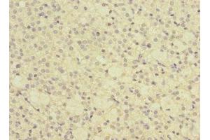 Immunohistochemistry of paraffin-embedded human adrenal gland tissue using ABIN7154564 at dilution of 1:100