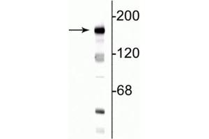 Western blot of 10  µg of rat hippocampal lysate showing specific immunolabeling of the ~180 kDa NR2B subunit of the NMDA receptor. (GRIN2B 抗体  (N-Term))