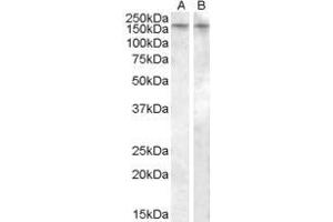 ABIN334355 (0. (AVPR1B 抗体  (C-Term))
