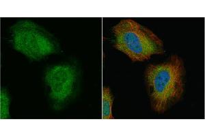 ICC/IF Image Transgelin antibody detects Transgelin protein at cytoplasm and nucleus by immunofluorescent analysis. (Transgelin 抗体)