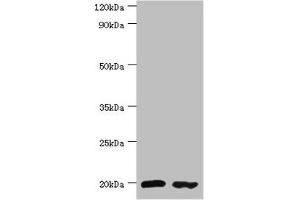 Western blot All lanes: Peptidyl-tRNA hydrolase 2, mitochondrial antibody at 4 μg/mL Lane 1: MM231 whole cell lysate Lane 2: Jurkat whole cell lysate Secondary Goat polyclonal to rabbit IgG at 1/10000 dilution Predicted band size: 19 kDa Observed band size: 19 kDa (PTRH2 抗体  (AA 40-179))