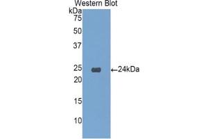 Western blot analysis of the recombinant protein. (IGFBP6 抗体  (AA 51-226))