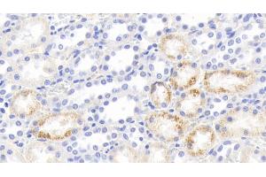Detection of IFNg in Rabbit Kidney Tissue using Polyclonal Antibody to Interferon Gamma (IFNg) (Interferon gamma 抗体  (AA 24-167))