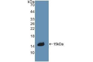 Detection of Recombinant CBG, Rat using Polyclonal Antibody to Corticosteroid Binding Globulin (CBG) (SERPINA6 抗体  (AA 267-390))