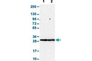 Western Blot analysis with FCGR3A polyclonal antibody . (FCGR3A 抗体  (AA 227-254))