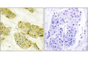 Immunohistochemistry (IHC) image for anti-Collagen, Type V, alpha 3 (COL5A3) (AA 221-270) antibody (ABIN2889917) (COL5A3 抗体  (AA 221-270))