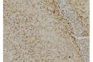 ABIN6256306 and ABIN6267377 at 1/100 staining mouse brain tissue by IHC-P. (GFAP 抗体  (pSer38))