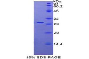 SDS-PAGE analysis of Mouse RARa Protein. (Retinoic Acid Receptor alpha 蛋白)