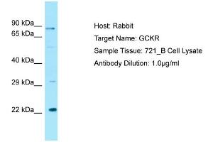 Host: RabbitTarget Name: GCKRAntibody Dilution: 1. (GCKR 抗体  (C-Term))