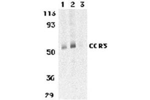 Western blot analysis of CCR3 in human spleen tissue lysates with AP30215PU-N CCR3 antibody at 1 (lane 1) and 2 μg/ml (lane 2), and 2 μg/ml in the presence of blocking peptide (lane 3). (CCR3 抗体  (C-Term))