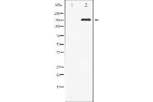 Western blot analysis of c-Met phosphorylation expression in HepG2 whole cell lysates,The lane on the left is treated with the antigen-specific peptide. (c-MET 抗体  (pTyr1003))