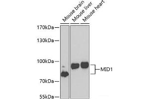 Western blot analysis of extracts of various cell lines using MID1 Polyclonal Antibody at dilution of 1:1000. (MID1 抗体)