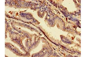 Immunohistochemistry of paraffin-embedded human prostate tissue using ABIN7158740 at dilution of 1:100 (ACP6 抗体  (AA 35-324))