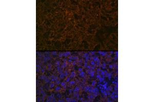 Immunofluorescence (IF) image for anti-Cytochrome P450, Family 26, Subfamily A, Polypeptide 1 (CYP26A1) antibody (ABIN7266654)