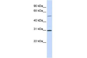 WB Suggested Anti-NEK3 Antibody Titration:  0. (NEK3 抗体  (N-Term))