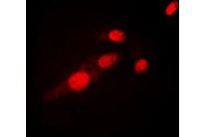 Immunofluorescent analysis of NF-kappaB p65 (AcK310) staining in HeLa cells. (NF-kB p65 抗体  (acLys310))