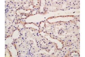 Formalin-fixed and paraffin embedded rat kidney tissue labeled with Rabbit Anti-NALP6 Polyclonal Antibody, Unconjugated (ABIN2559652) at 1:200 followed by conjugation to the secondary antibody and DAB staining (NLRP6 抗体  (AA 351-450))