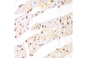 Immunohistochemistry of paraffin-embedded mouse heart using Nono Antibody (ABIN5973035) at dilution of 1/100 (40x lens). (NONO 抗体)