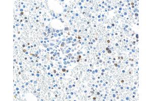 Immunohistochemistry (IHC) image for anti-Transforming Growth Factor, beta 1 (TGFB1) (AA 325-375) antibody (ABIN7449529) (Recombinant TGFB1 抗体  (AA 325-375))