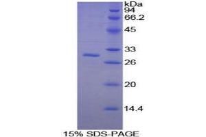 SDS-PAGE analysis of Mouse PAFAH1B3 Protein. (PAFAH1B3 蛋白)